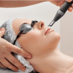 Understanding the Benefits, Results, and Expectations of Laser Treatments for Hyperpigmentation