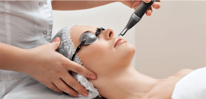 Understanding the Benefits, Results, and Expectations of Laser Treatments for Hyperpigmentation